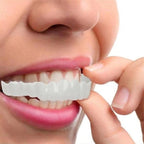 Snap On Veneers - Upper and Lower Teeth Cover