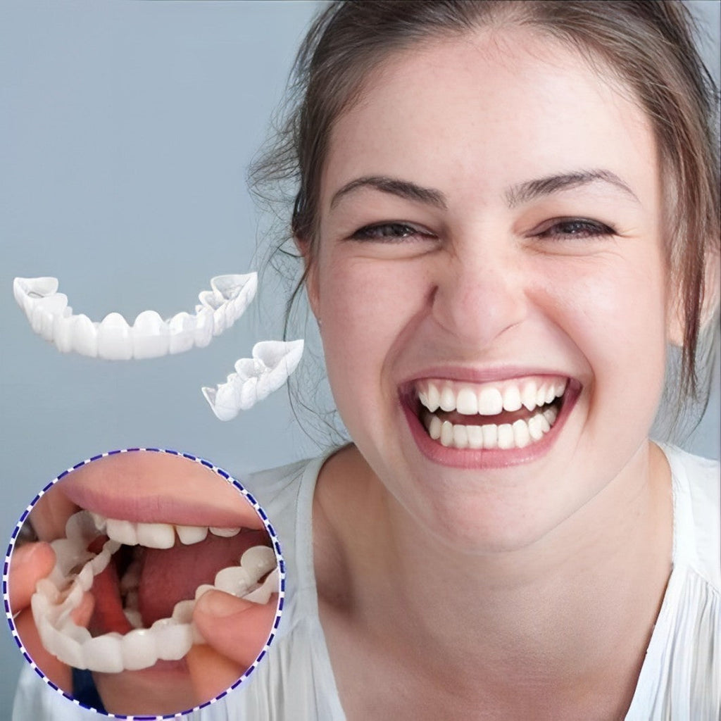 Snap On Veneers - Upper and Lower Teeth Cover