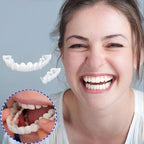 Snap On Veneers - Upper and Lower Teeth Cover