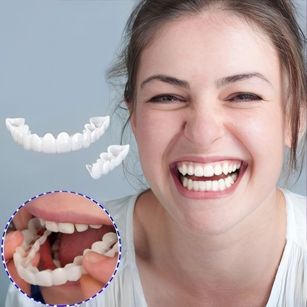 Snap On Veneers - Upper and Lower Teeth Cover