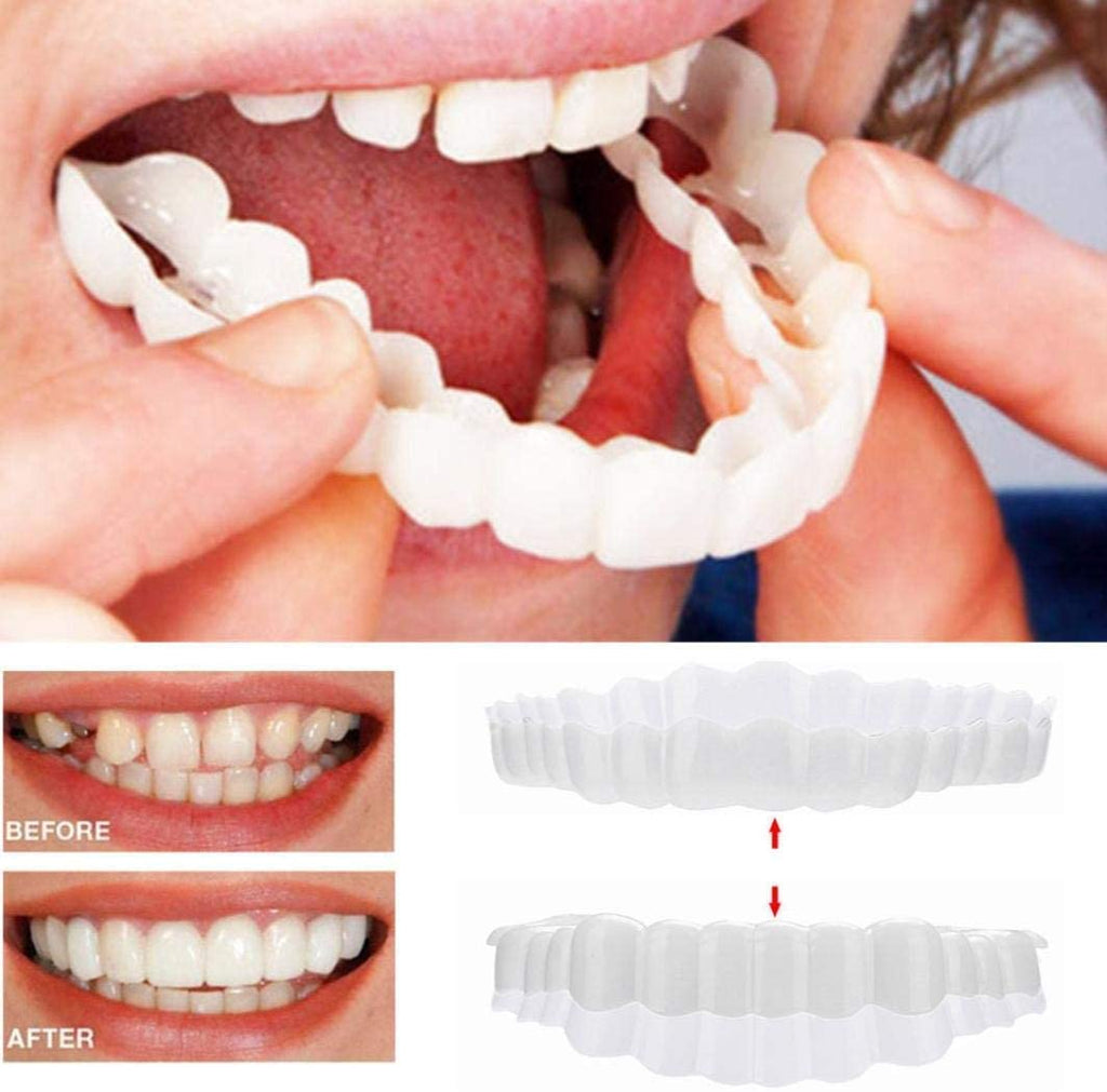 Snap On Veneers - Upper and Lower Teeth Cover