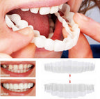 Snap On Veneers - Upper and Lower Teeth Cover