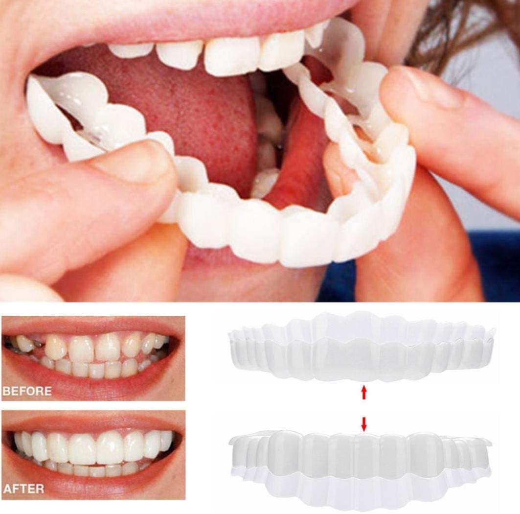 Snap On Veneers - Upper and Lower Teeth Cover