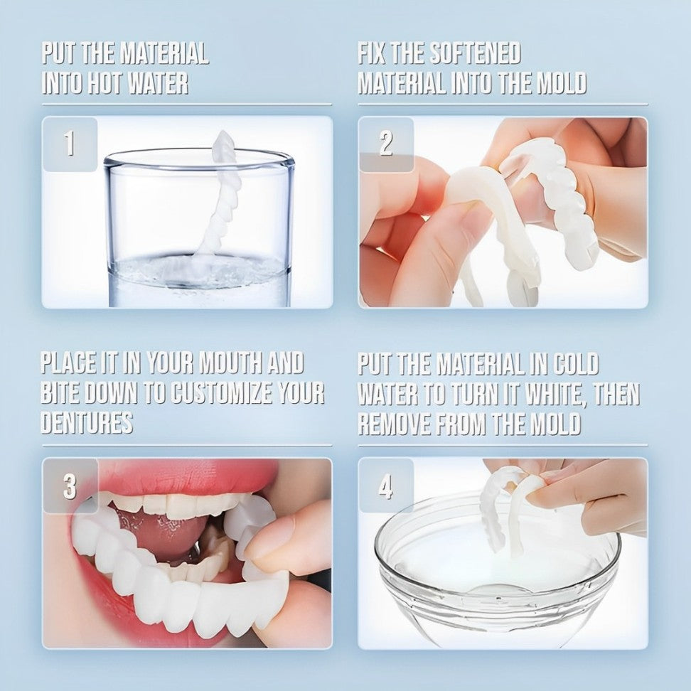 Snap On Veneers - Upper and Lower Teeth Cover