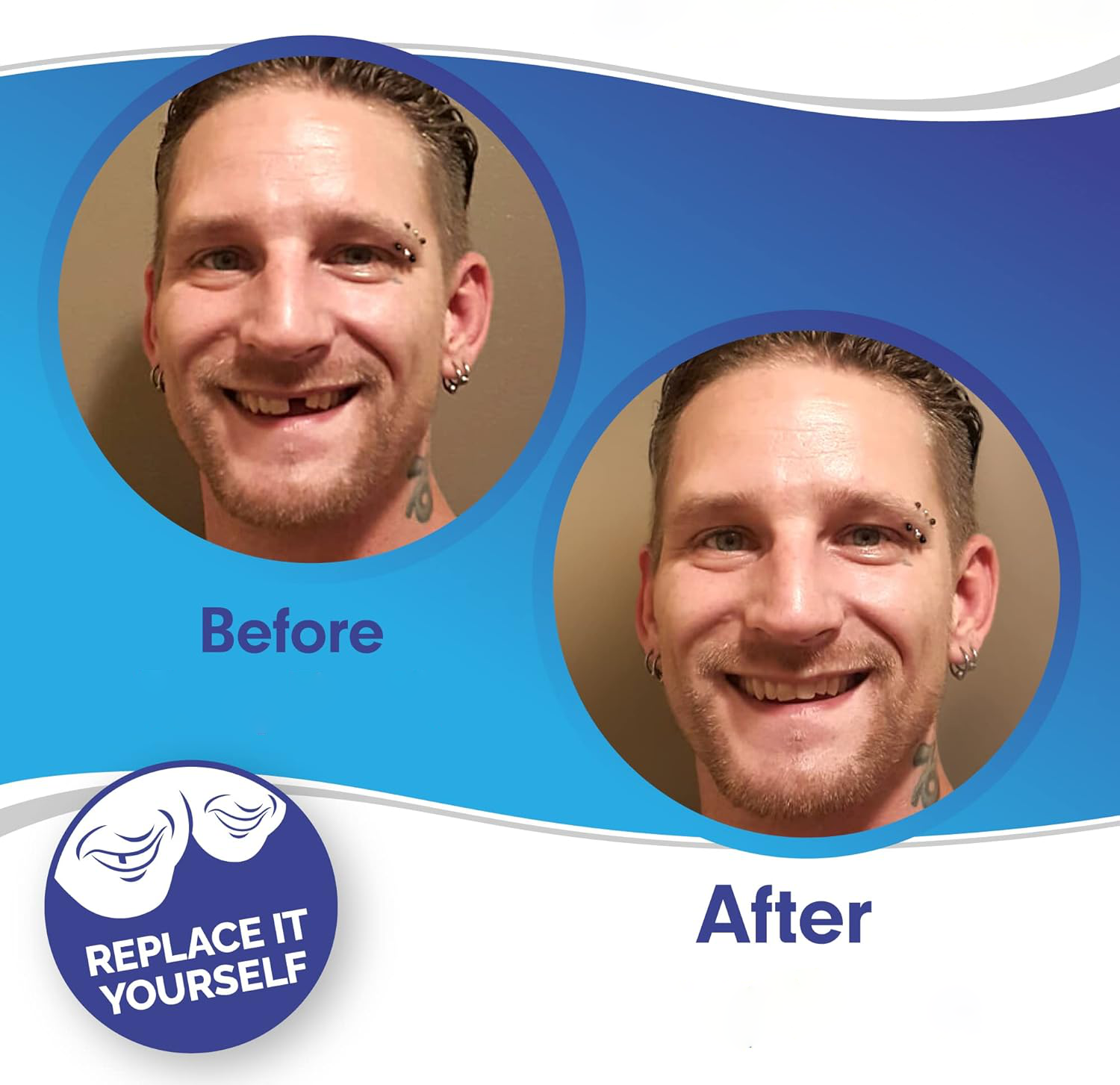 Snap On Veneers - Upper and Lower Teeth Cover