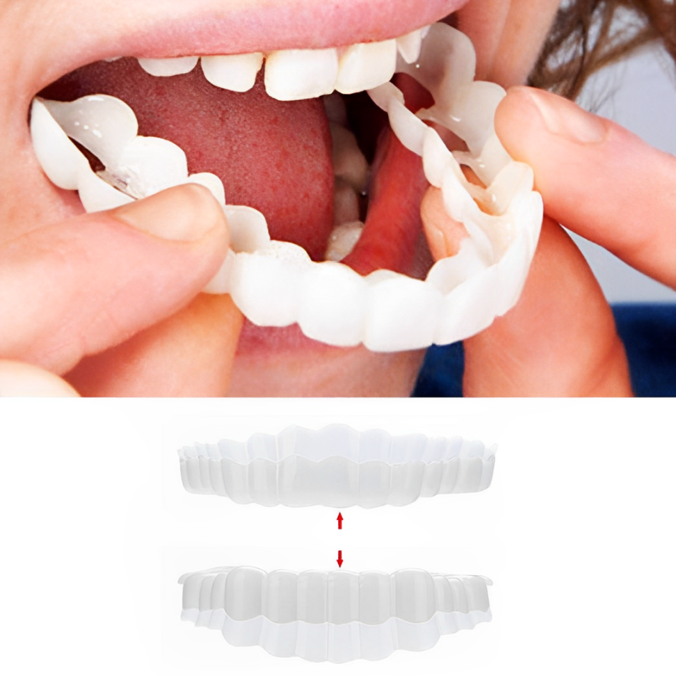 Snap On Veneers - Upper and Lower Teeth Cover