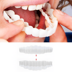 Snap On Veneers - Upper and Lower Teeth Cover