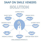 Snap On Veneers - Upper and Lower Teeth Cover